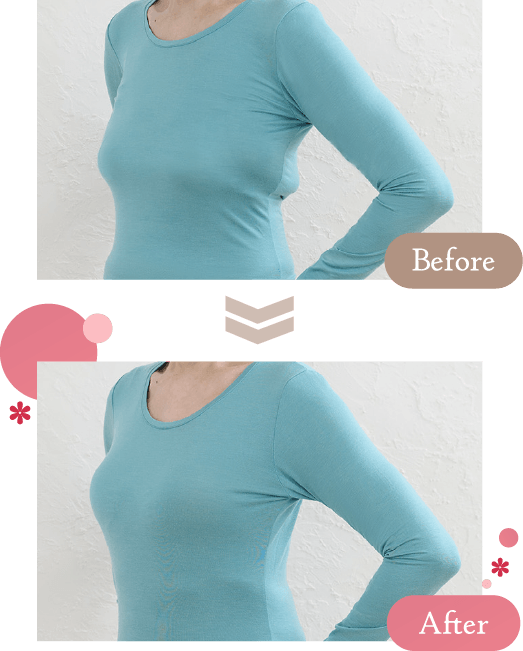 Before��After