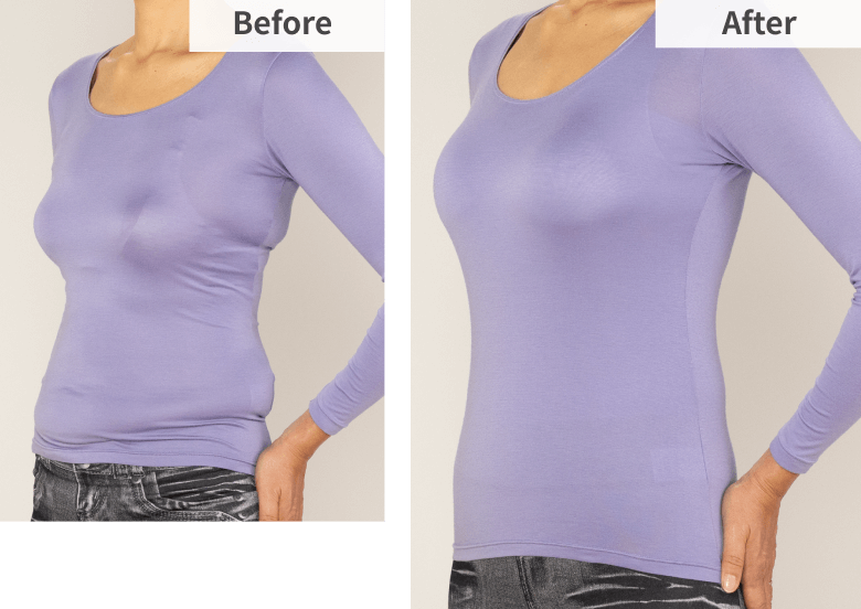 Before After