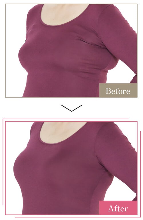 �W�j�G�C���e�O���[�g�u���𒅗p���Ă�����before,after�̎ʐ^