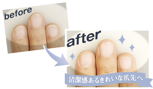 before after