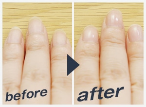 before after