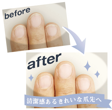 before after