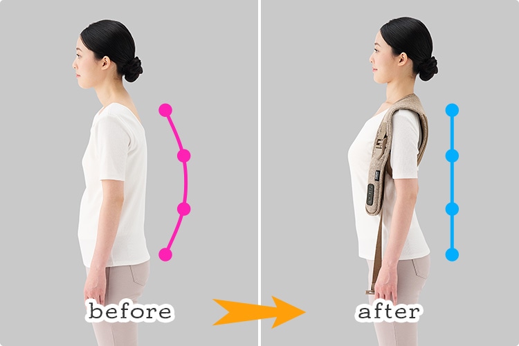 before &rarr; after